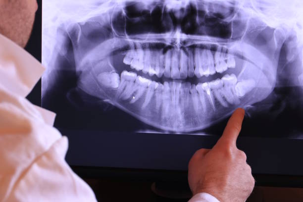 Best Dentist for Tooth Abscess  in Fort Knox, KY